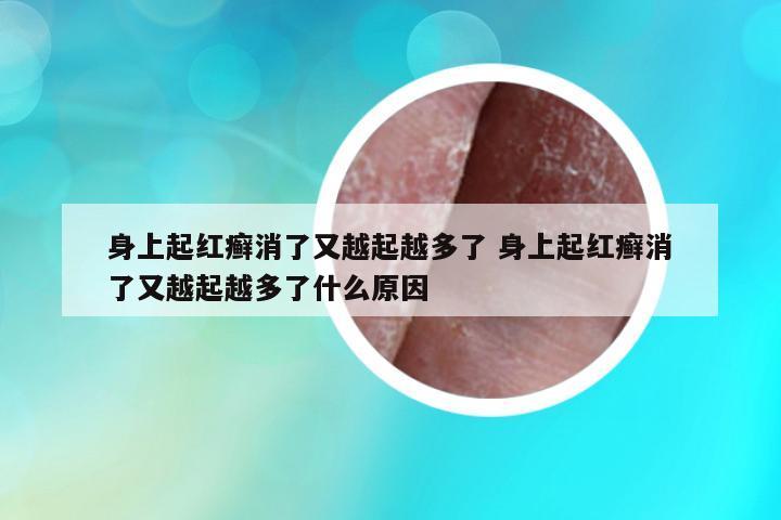 身上起紅癬消了又越起越多了 身上起紅癬消了又越起越多了什么原因