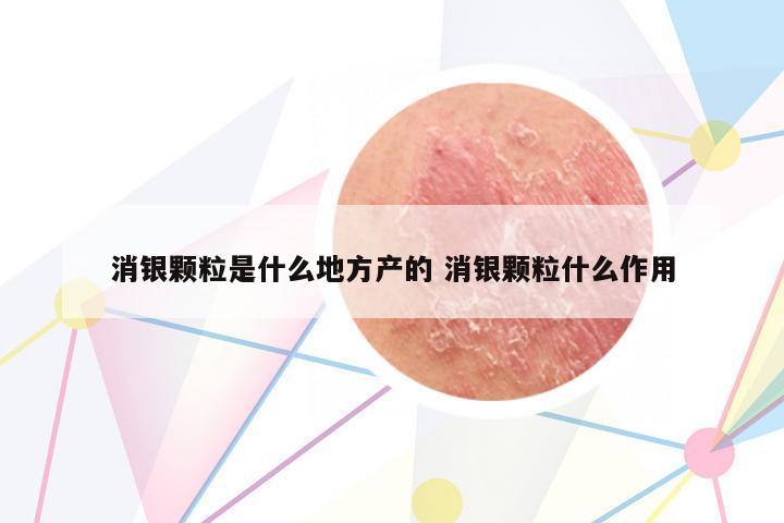 消銀顆粒是什么地方產(chǎn)的 消銀顆粒什么作用
