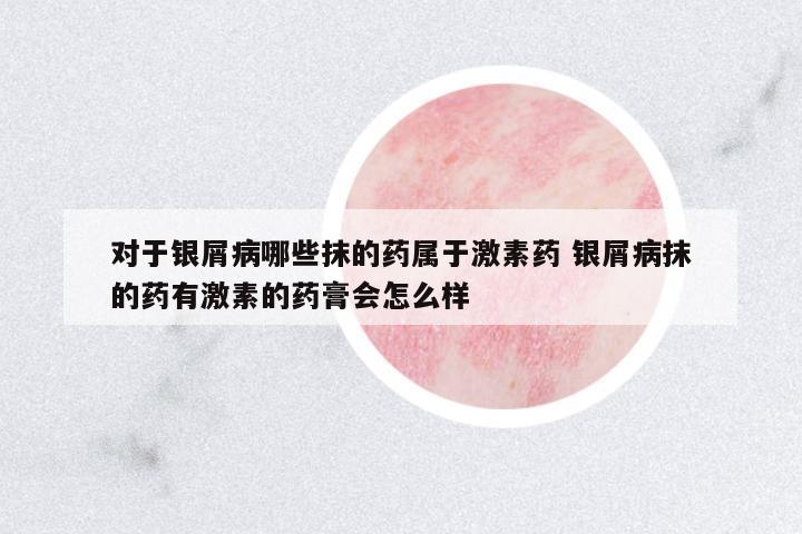 對(duì)于銀屑病哪些抹的藥屬于激素藥 銀屑病抹的藥有激素的藥膏會(huì)怎么樣