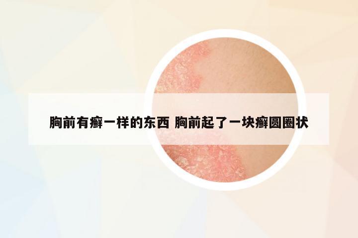 胸前有癬一樣的東西 胸前起了一塊癬圓圈狀