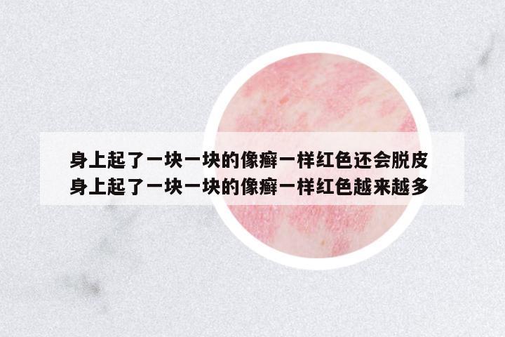 身上起了一塊一塊的像癬一樣紅色還會(huì)脫皮 身上起了一塊一塊的像癬一樣紅色越來越多