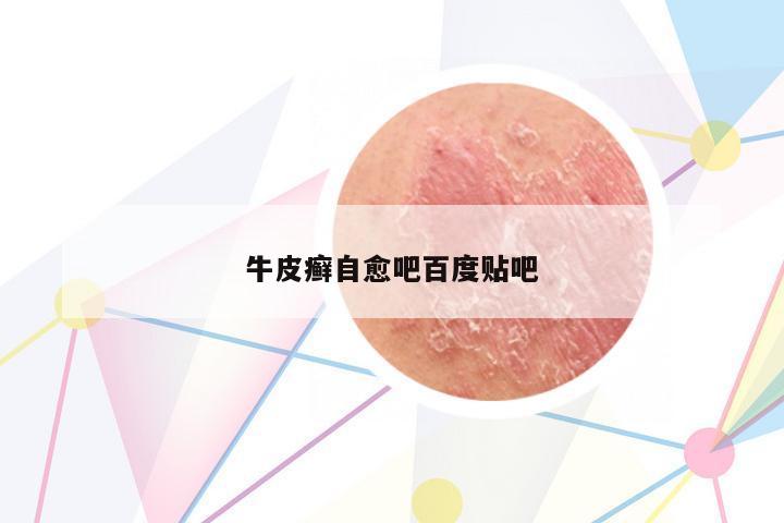 牛皮癬自愈吧百度貼吧