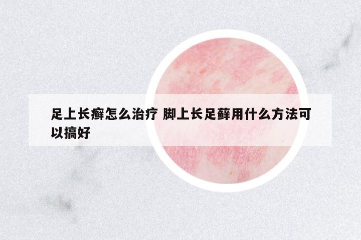 足上長癬怎么治療 腳上長足蘚用什么方法可以搞好