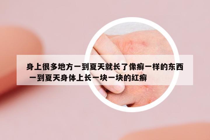 身上很多地方一到夏天就長(zhǎng)了像癬一樣的東西 一到夏天身體上長(zhǎng)一塊一塊的紅癬