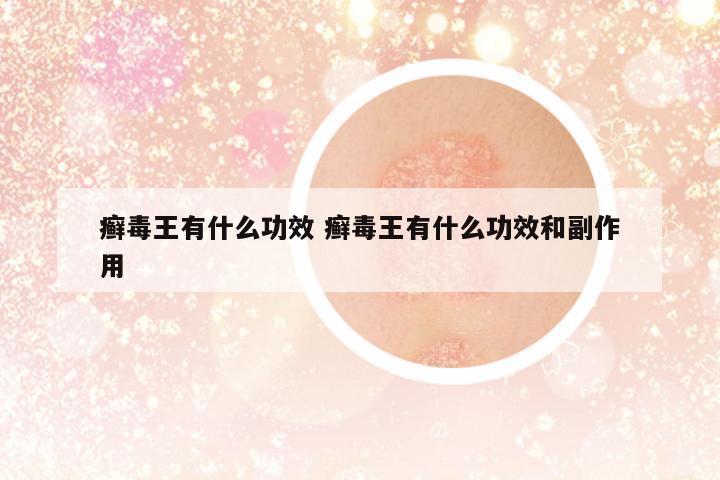 癬毒王有什么功效 癬毒王有什么功效和副作用