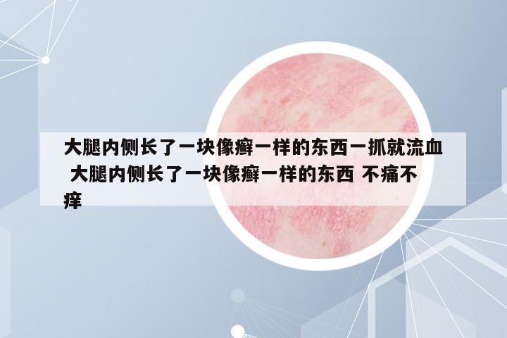 大腿內側長了一塊像癬一樣的東西一抓就流血 大腿內側長了一塊像癬一樣的東西 不痛不癢