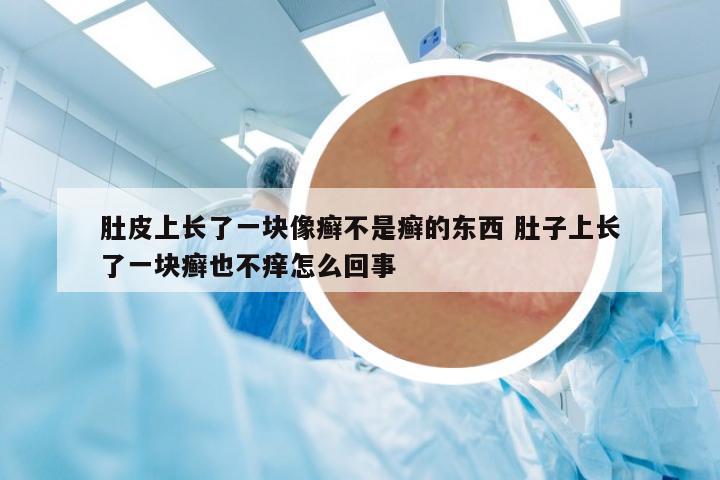 肚皮上長了一塊像癬不是癬的東西 肚子上長了一塊癬也不癢怎么回事