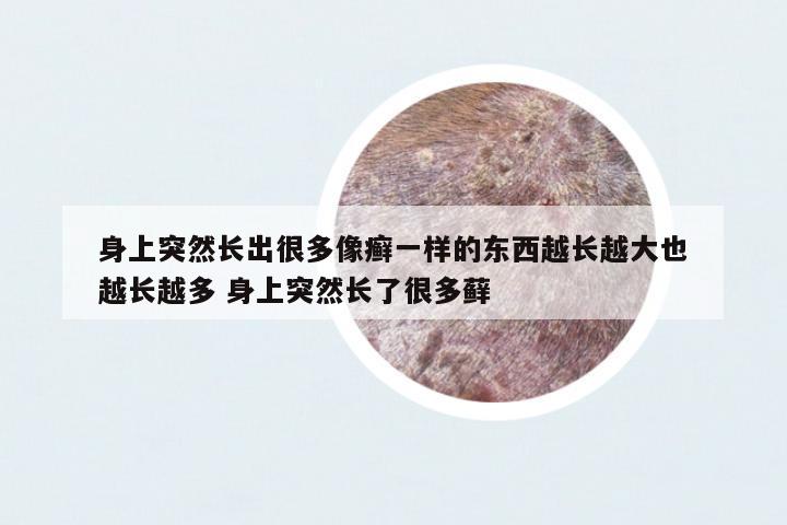 身上突然長出很多像癬一樣的東西越長越大也越長越多 身上突然長了很多蘚