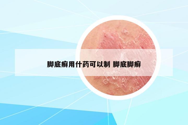 腳底癬用什藥可以制 腳底腳癬