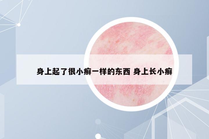 身上起了很小癬一樣的東西 身上長(zhǎng)小癬