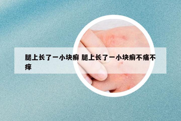 腿上長(zhǎng)了一小塊癬 腿上長(zhǎng)了一小塊癬不痛不癢
