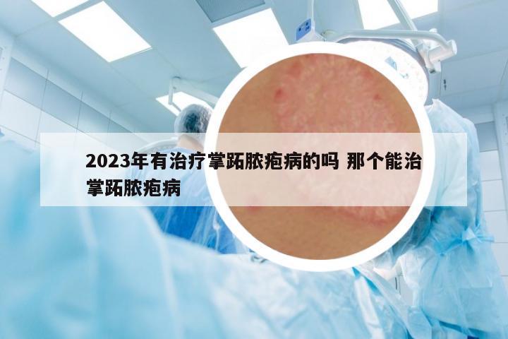 2023年有治療掌跖膿皰病的嗎 那個能治掌跖膿皰病