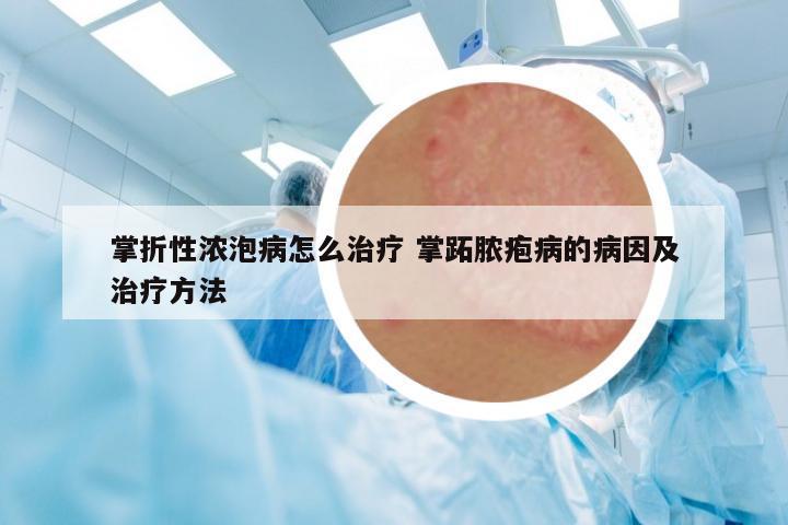 掌折性濃泡病怎么治療 掌跖膿皰病的病因及治療方法
