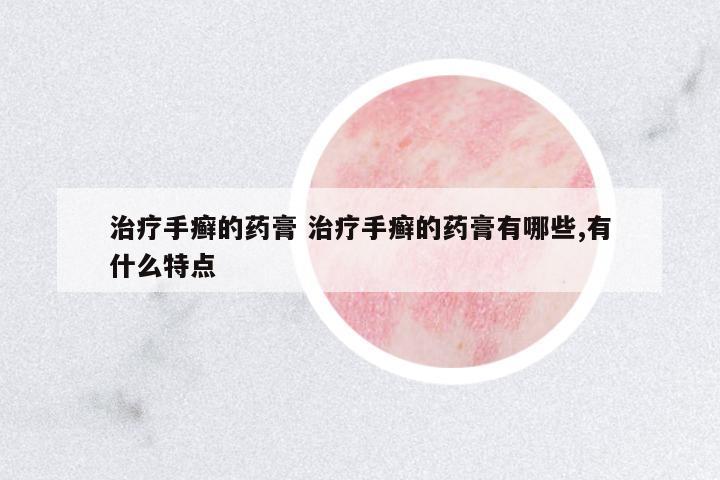 治療手癬的藥膏 治療手癬的藥膏有哪些,有什么特點(diǎn)