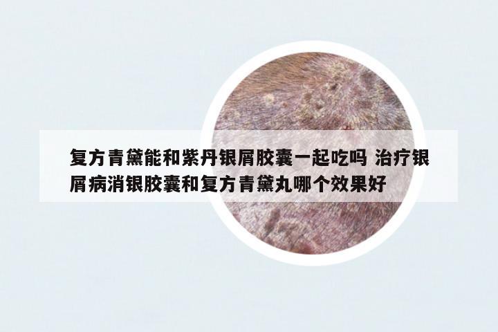 復方青黛能和紫丹銀屑膠囊一起吃嗎 治療銀屑病消銀膠囊和復方青黛丸哪個效果好