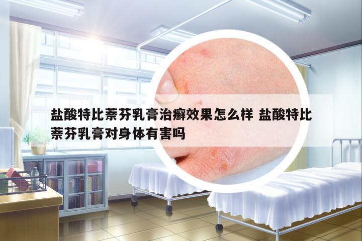 鹽酸特比萘芬乳膏治癬效果怎么樣 鹽酸特比萘芬乳膏對身體有害嗎
