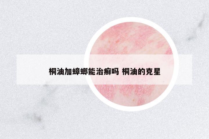 桐油加蟑螂能治癬嗎 桐油的克星