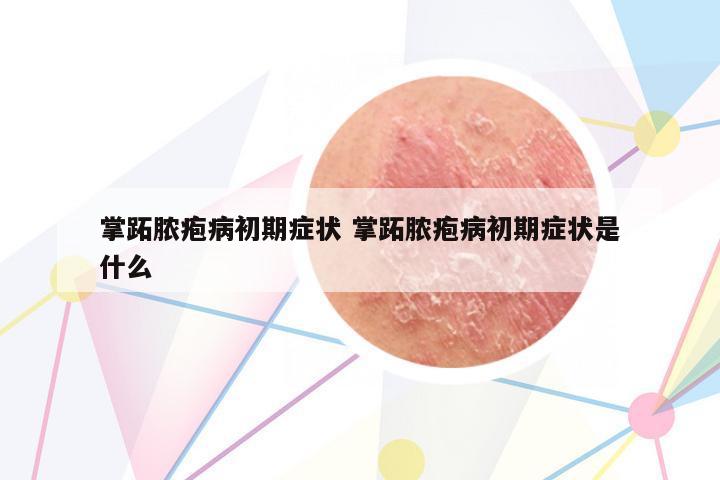 掌跖膿皰病初期癥狀 掌跖膿皰病初期癥狀是什么