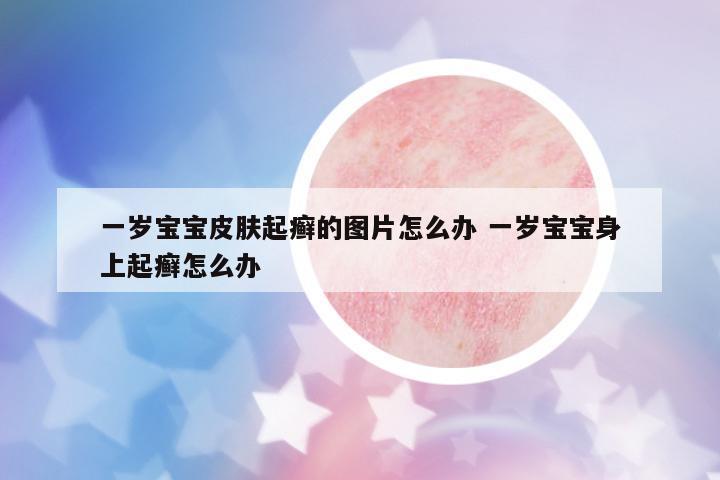 一歲寶寶皮膚起癬的圖片怎么辦 一歲寶寶身上起癬怎么辦