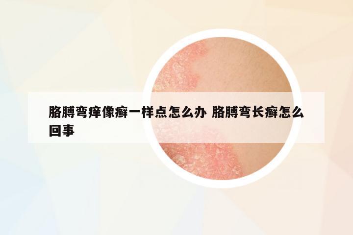 胳膊彎癢像癬一樣點(diǎn)怎么辦 胳膊彎長癬怎么回事