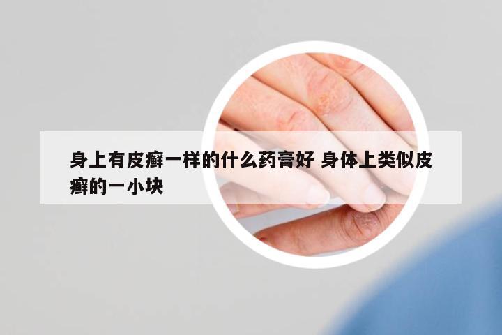 身上有皮癬一樣的什么藥膏好 身體上類似皮癬的一小塊