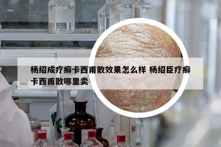 楊紹成療癬卡西甫散效果怎么樣 楊紹臣療癬卡西甫散哪里賣