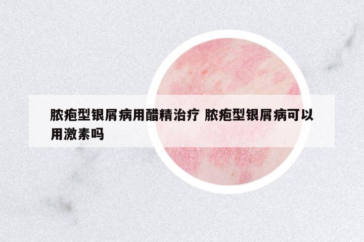 膿皰型銀屑病用醋精治療 膿皰型銀屑病可以用激素嗎