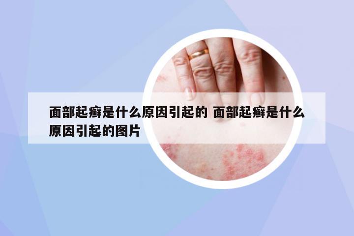 面部起癬是什么原因引起的 面部起癬是什么原因引起的圖片