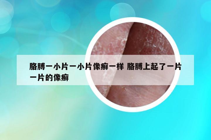 胳膊一小片一小片像癬一樣 胳膊上起了一片一片的像癬