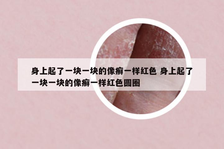 身上起了一塊一塊的像癬一樣紅色 身上起了一塊一塊的像癬一樣紅色圓圈