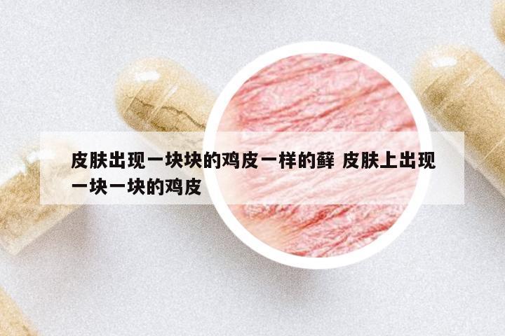 皮膚出現(xiàn)一塊塊的雞皮一樣的蘚 皮膚上出現(xiàn)一塊一塊的雞皮
