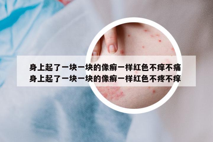 身上起了一塊一塊的像癬一樣紅色不癢不痛 身上起了一塊一塊的像癬一樣紅色不疼不癢