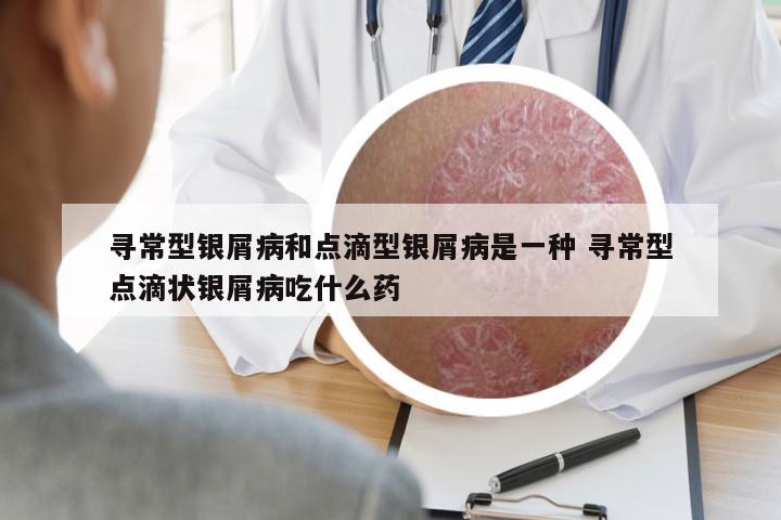 尋常型銀屑病和點滴型銀屑病是一種 尋常型點滴狀銀屑病吃什么藥