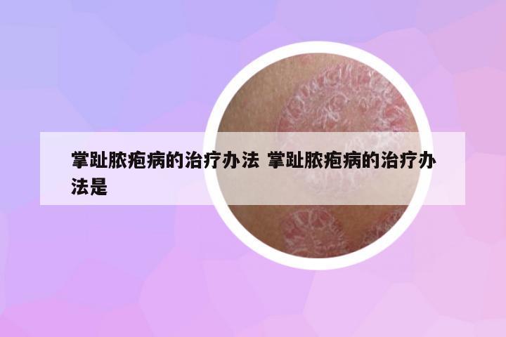 掌趾膿皰病的治療辦法 掌趾膿皰病的治療辦法是