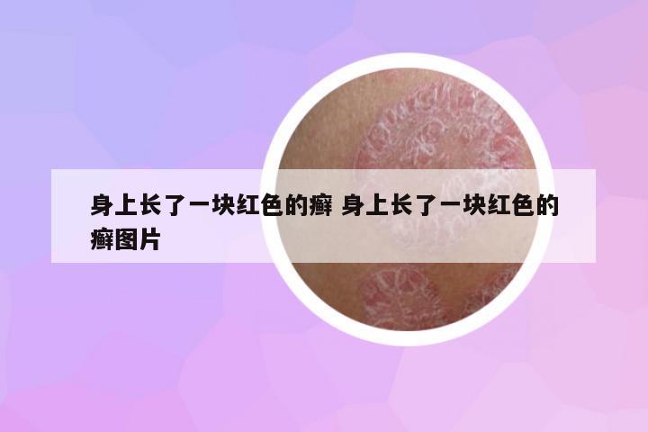身上長了一塊紅色的癬 身上長了一塊紅色的癬圖片