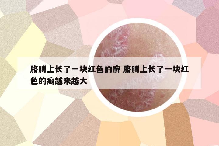 胳膊上長了一塊紅色的癬 胳膊上長了一塊紅色的癬越來越大