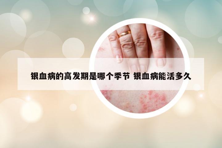 銀血病的高發(fā)期是哪個季節(jié) 銀血病能活多久
