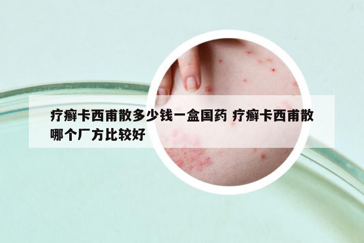 療癬卡西甫散多少錢(qián)一盒國(guó)藥 療癬卡西甫散哪個(gè)廠方比較好