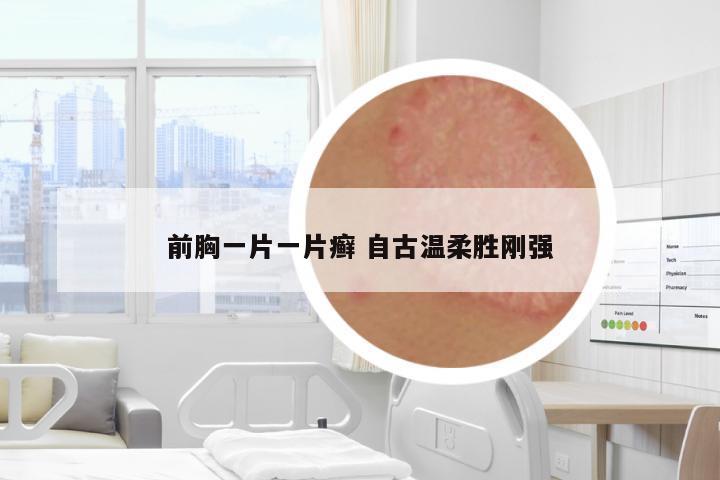 前胸一片一片癬 自古溫柔勝剛強(qiáng)