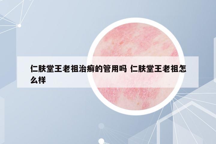 仁膚堂王老祖治癬的管用嗎 仁膚堂王老祖怎么樣
