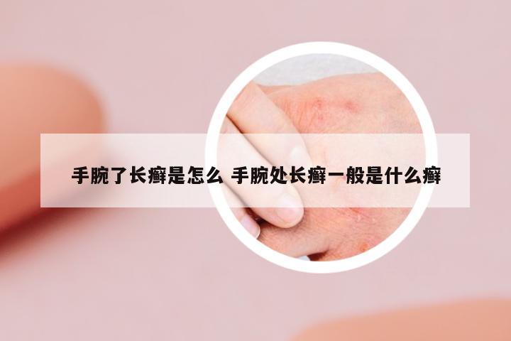 手腕了長癬是怎么 手腕處長癬一般是什么癬