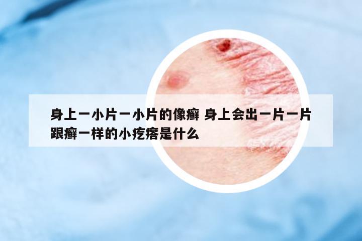 身上一小片一小片的像癬 身上會出一片一片跟癬一樣的小疙瘩是什么