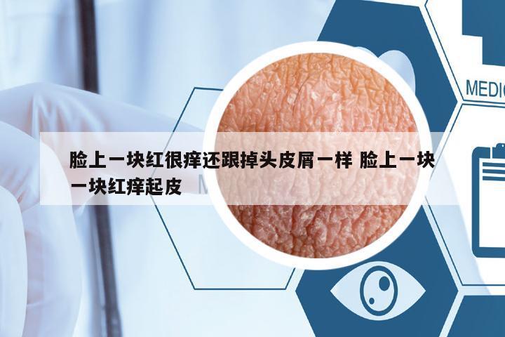 臉上一塊紅很癢還跟掉頭皮屑一樣 臉上一塊一塊紅癢起皮