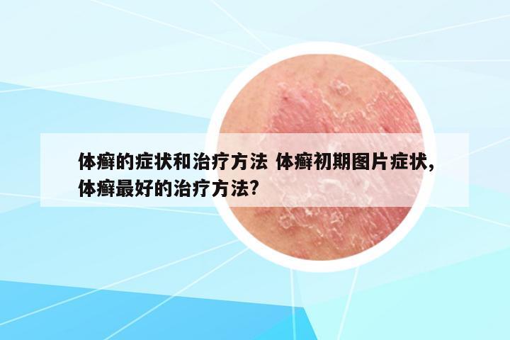 體癬的癥狀和治療方法 體癬初期圖片癥狀,體癬最好的治療方法?