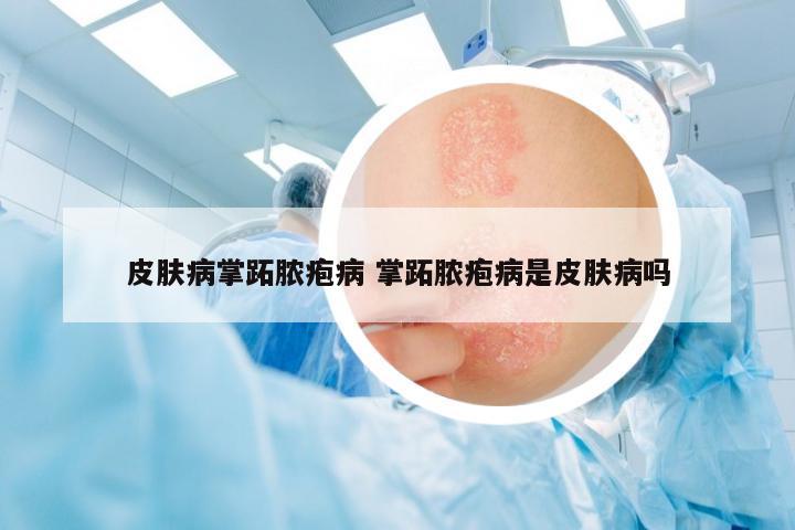 皮膚病掌跖膿皰病 掌跖膿皰病是皮膚病嗎