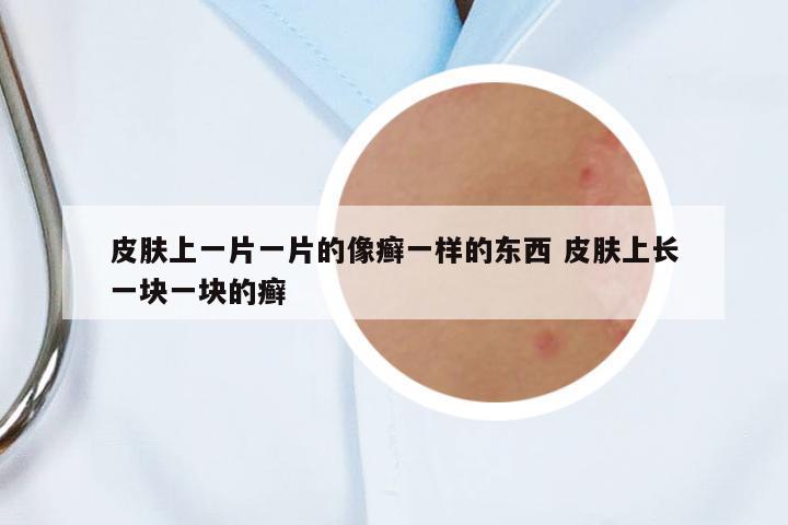 皮膚上一片一片的像癬一樣的東西 皮膚上長一塊一塊的癬