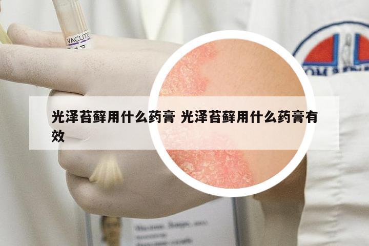 光澤苔蘚用什么藥膏 光澤苔蘚用什么藥膏有效