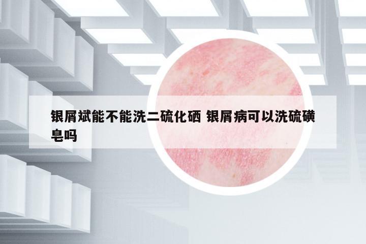 銀屑斌能不能洗二硫化硒 銀屑病可以洗硫磺皂嗎