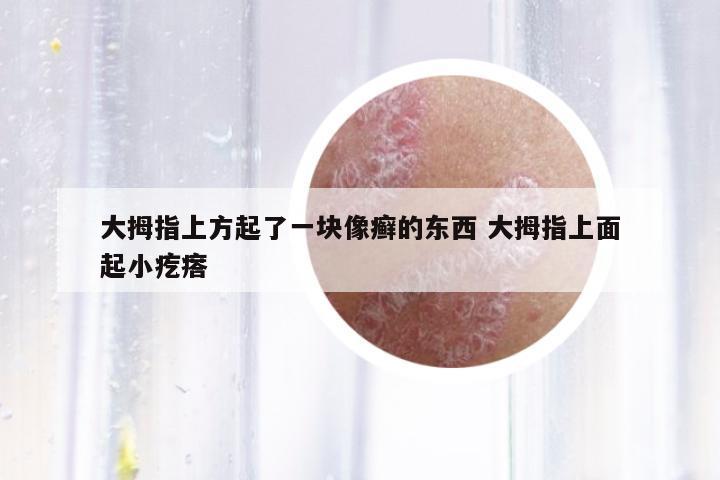 大拇指上方起了一塊像癬的東西 大拇指上面起小疙瘩