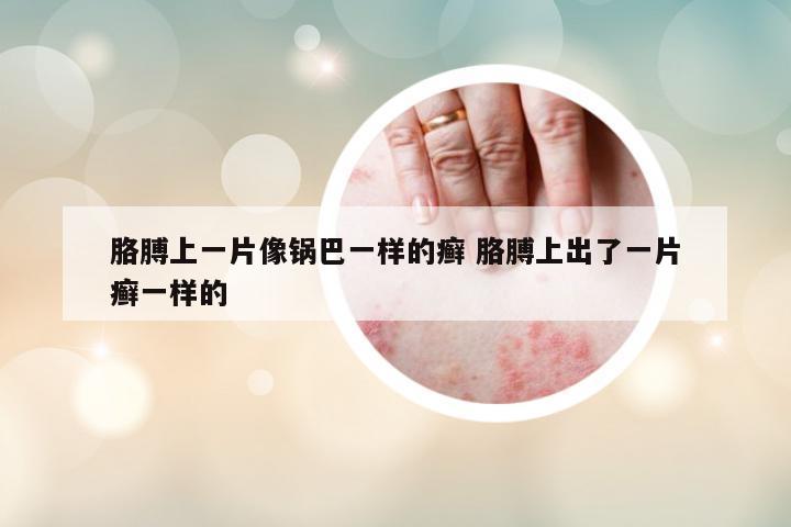 胳膊上一片像鍋巴一樣的癬 胳膊上出了一片癬一樣的